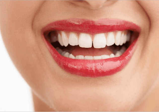 دندان‌های فاصله‌دار